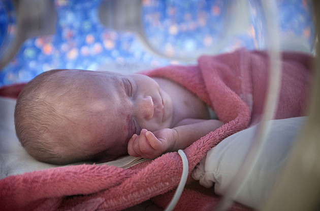 Čeští lékaři umí věštit předčasný porod. Zahájili unikátní výzkum, může v budoucnu zachránit tisíce miminek