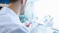 Onkolytická viroterapie vypadá jako vyhán�ní �erta �áblem � viry b�hem ní...