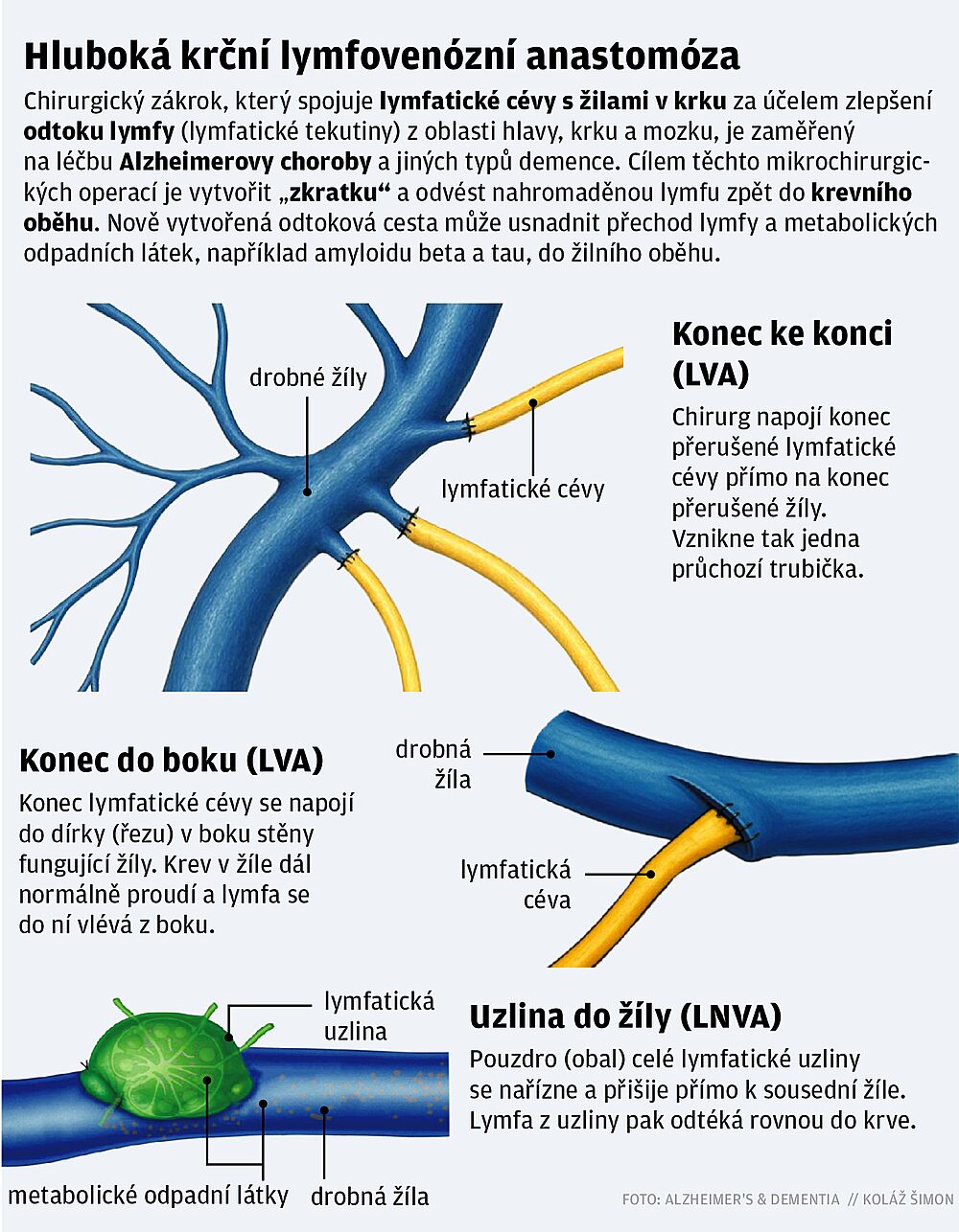Hluboká krční lymfovenózní anastomóza