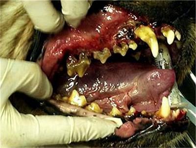 zubní kámen a parodontitis