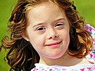 3 Down syndrom ve v�ku cca 11 let