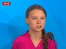 5 obli�ej osoby s Downovýn syndromem