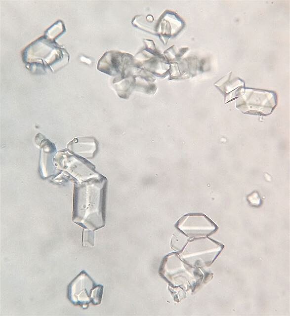 Struvity v moi kocoura Franka - mikroskopický snímek z veteriny