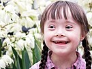 3 Down syndrom u dít�te