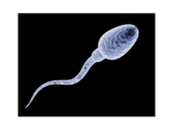 sperm