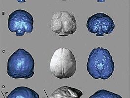 3D zobrazen mozku zleva dvou mikrokefalik a vpravo mozku LB1 z Flores