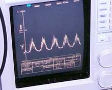 10 GHz signal