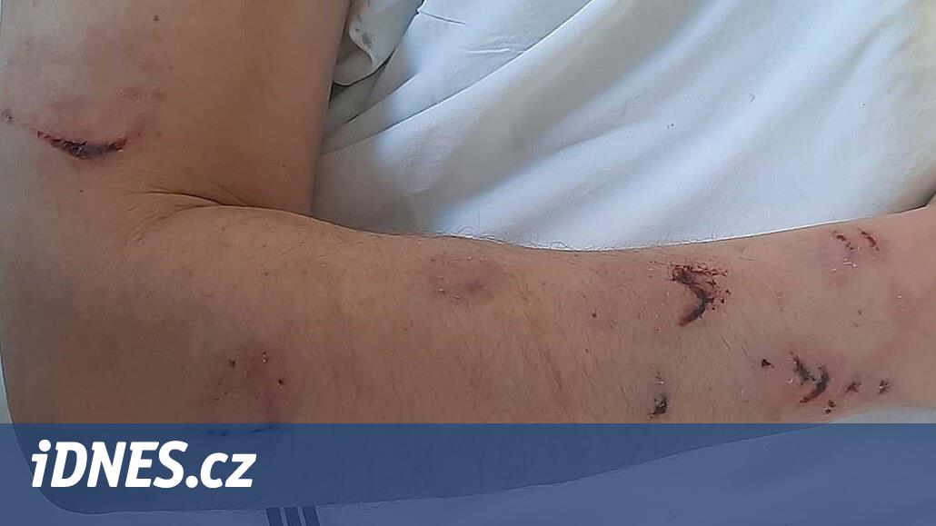 Jerk, al onu, şizofren köpeği adamın üzerine fırlattı.  Mahkeme onun deli olduğunu söyledi