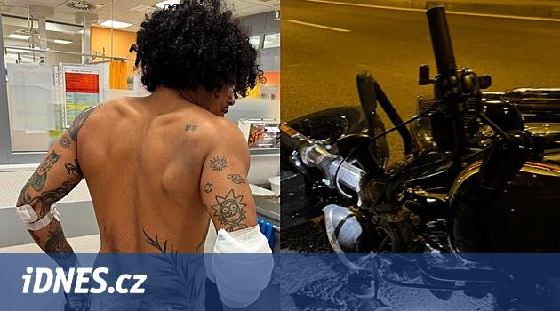Cristovao ukázal fotky zranění po nehodě na motorce - iDNES.cz