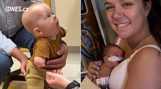 Chlapeček se narodil bez končetin, už nyní je hvězdou internetu