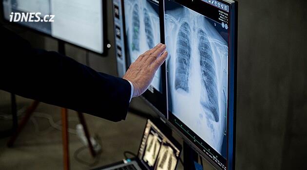 Dvě třetiny nemocnic využívají umělou inteligenci, Vojtěch chystá novou strategii