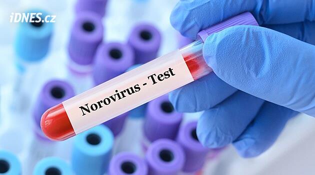Hijyenistler, Sečská barajında ​​tekrarlanan norovirüs vakalarıyla ilgileniyor