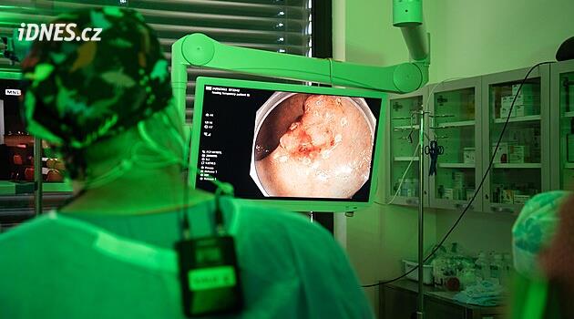 FN Olomouc yapay zeka kolonoskopisini kullandı, tarih ekleyecek