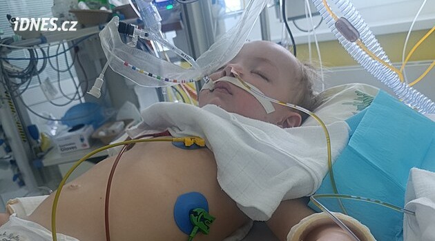 Prostějov'lu iki yaşındaki bir çocuk bir parça armut soludu ve komaya girdi