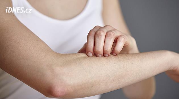 V Praze přibylo lidí nakažených svrabem, cestování MHD je rizikové minimálně
