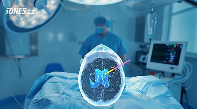 Umělá inteligence a 3D brýle. Nový pomocník budějovických neurochirurgů