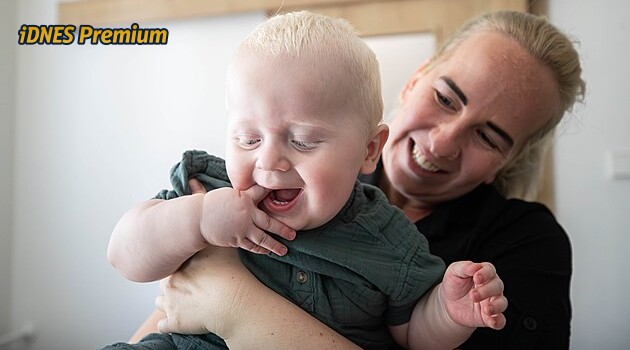 Měl oči jako upír, nereagoval na světlo. Kvůli albinismu a špatnému zraku Adámek maminku nevidí